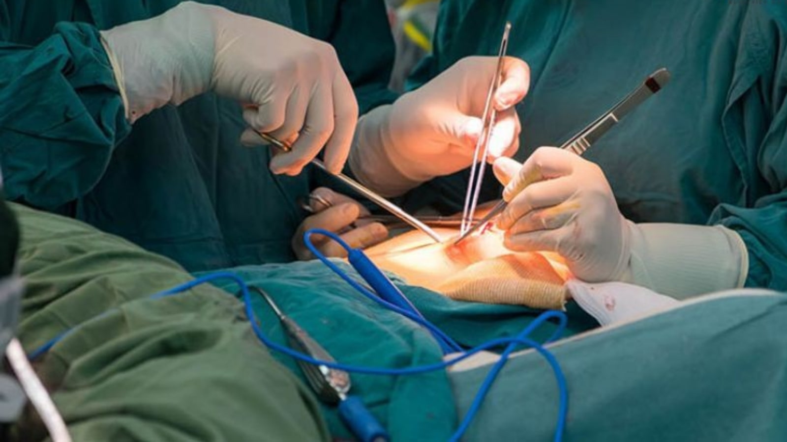 kinh nghiệm chữa lạc nội mạc tử cung