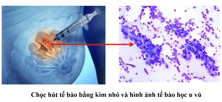 Phương Pháp Điều Trị Can Thiệp